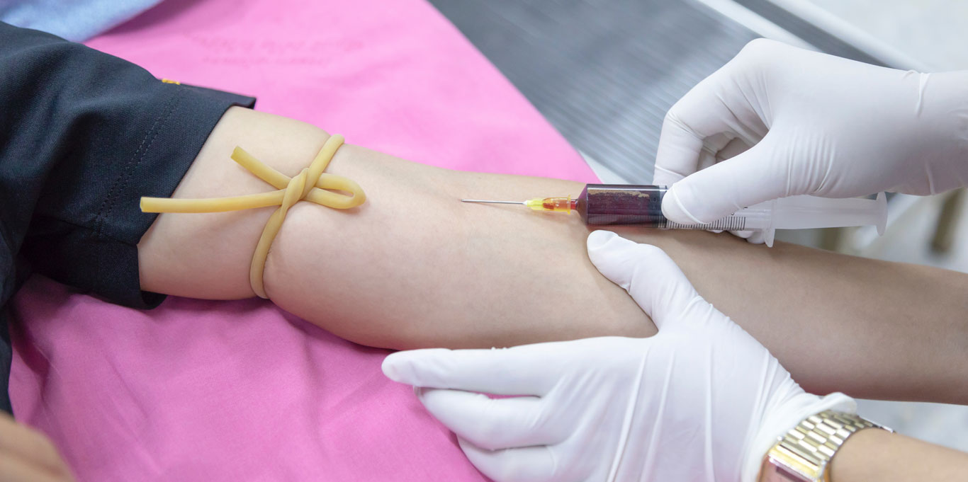 Patient presents arm for a blood test; syringe fills with patient’s blood